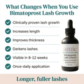 Bimatoprost (Lash Growth)