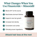 Finasteride + Minoxidil Capsules