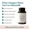 Minoxidil