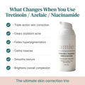 Tretinoin / Azelaic Acid / Niacinamide Cream